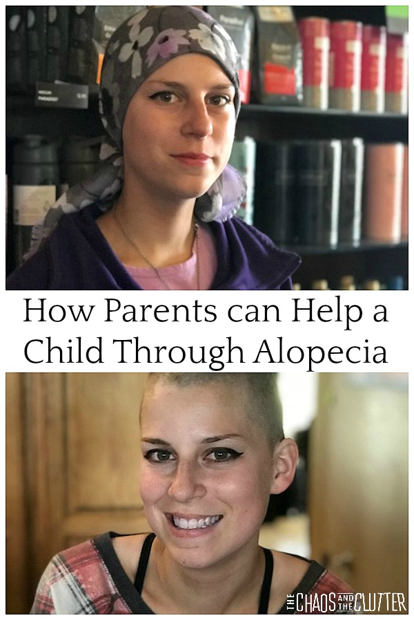 How Parents Can Help a Child Through Alopecia #alopecia #specialneedsparenting #parentingtips